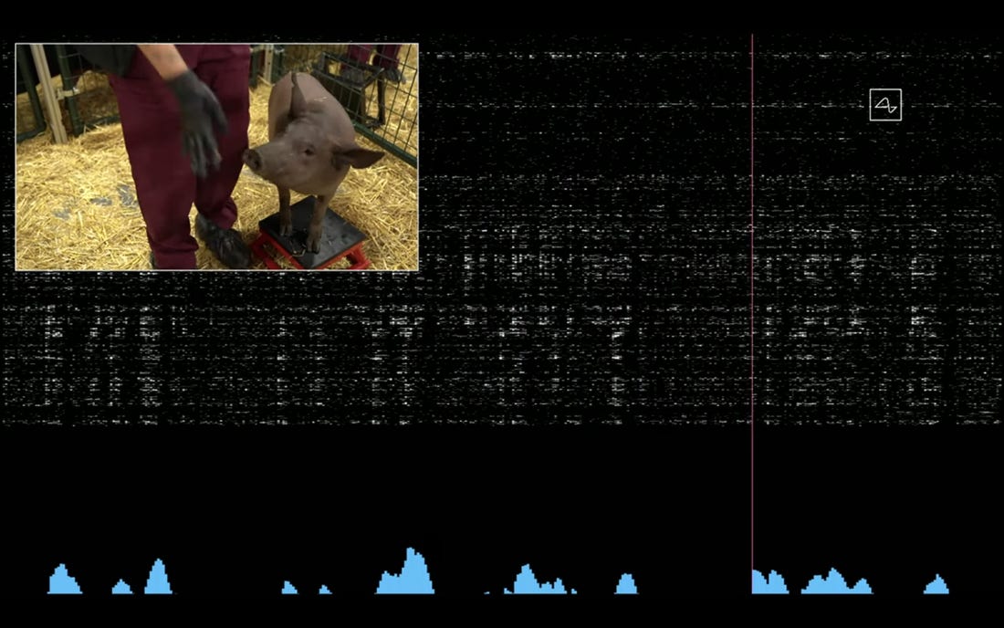 Elon Musk Beyin-Bilgisayar Teknolojisini Duyurdu!
